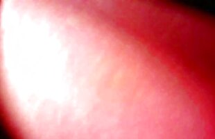 Posted under webbed toes, web, footage, rico