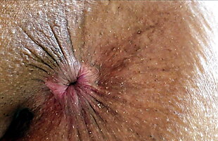 Posted under to big for teens, nu19comsex video, backdoor anal, sandysecret video